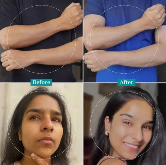 Pilgrim Korean Peeling Solution - 25% AHA, 2% BHA, 5% PHA